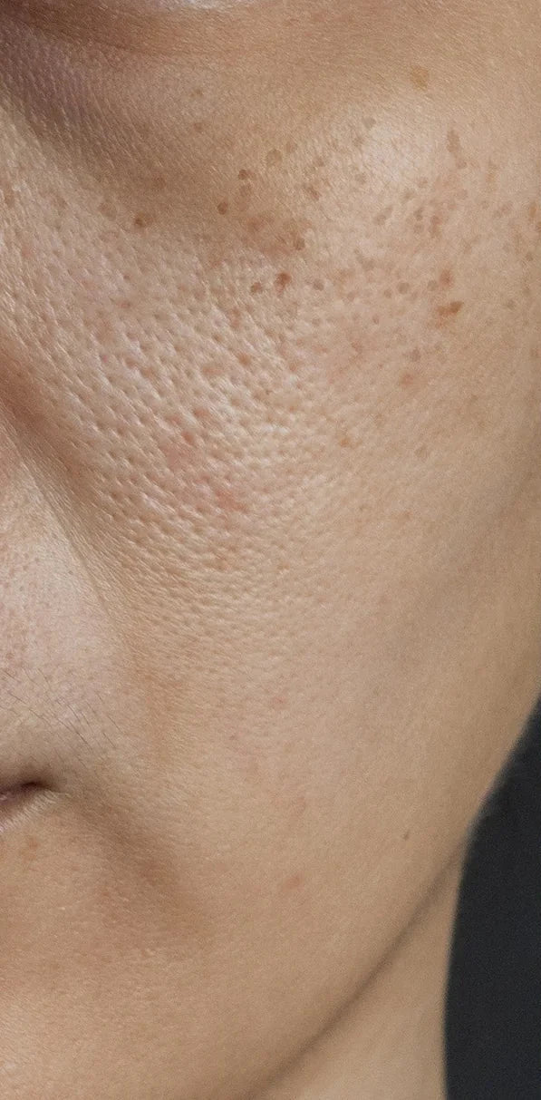 Before using Melaxin Balm